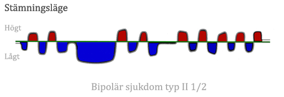 Bipolär typ 2b